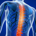 back pain treatments