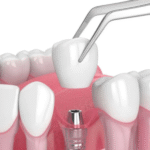 Stroud dentist Innisfil