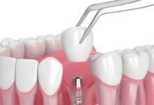 Stroud dentist Innisfil