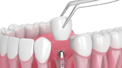 Stroud dentist Innisfil