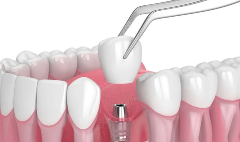 Stroud dentist Innisfil